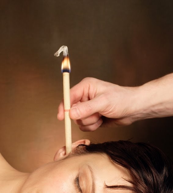 ear candling therapy treatment